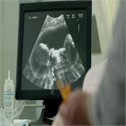 Doritos: "Ultrasound Baby"