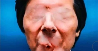 Erm So That Just Happened